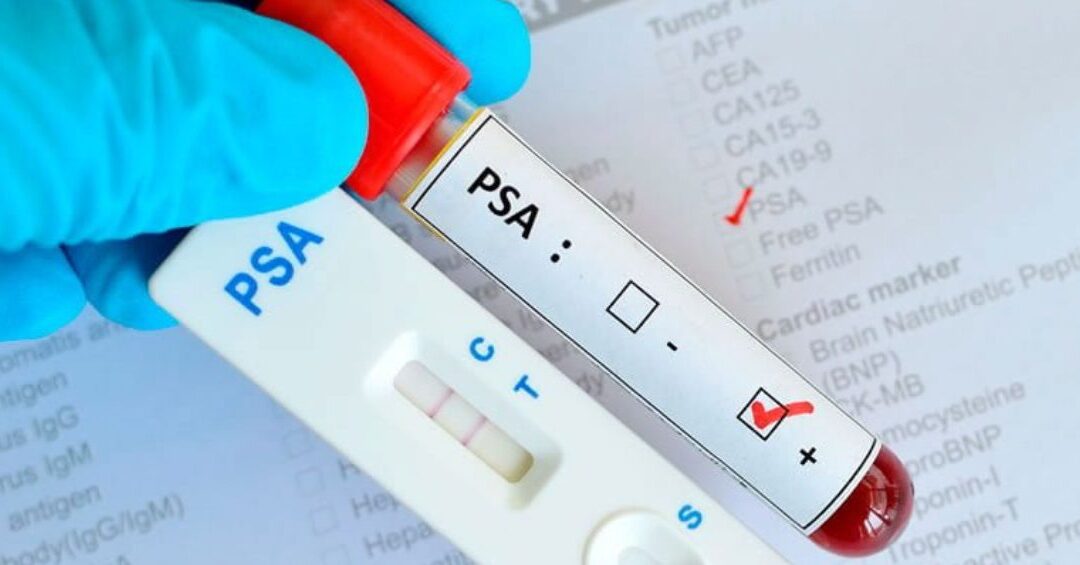 ISSEMyM recomienda prueba de antígenos para detectar cáncer de próstata